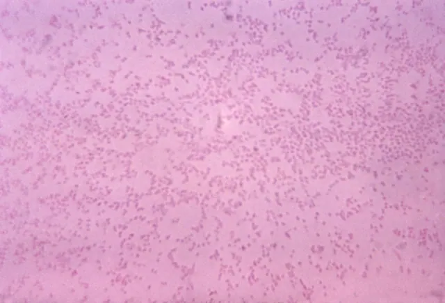 Microscope image of Pasteurella multocida, a relative of Bisgaard taxon 45