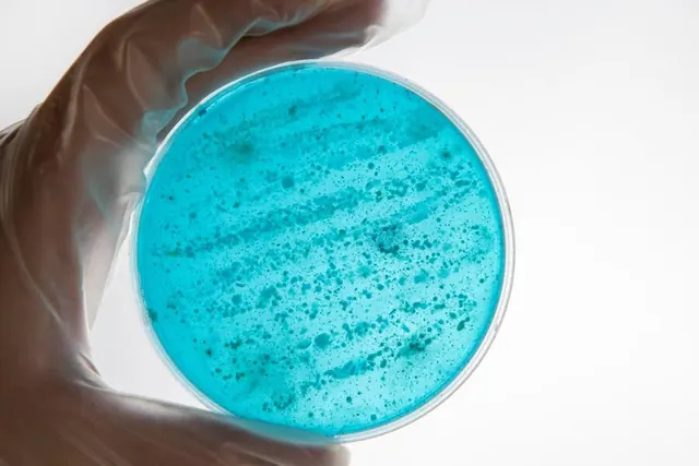 A laboratory culture dish