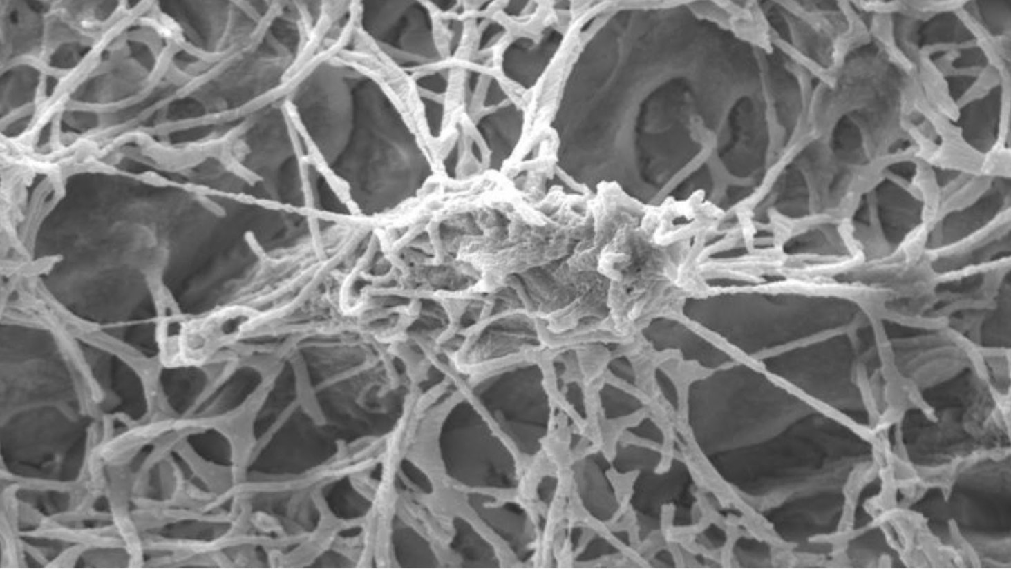 Illustrative microscopic image of branching bone-like structures; not a study figure.